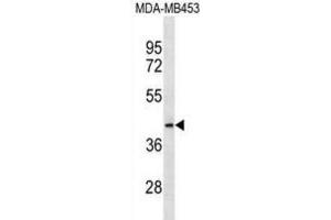 Western Blotting (WB) image for anti-Mitochondrial Ribosomal Protein L46 (MRPL46) antibody (ABIN3000730) (MRPL46 Antikörper)