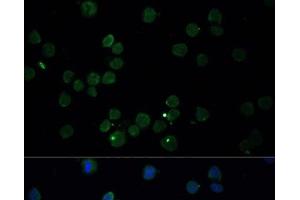 Immunofluorescence analysis of THP-1 cells using CHAT Polyclonal Antibody at dilution of 1:100. (Choline Acetyltransferase Antikörper)