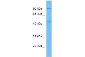 Host:  Rabbit  Target Name:  E2F3  Sample Tissue:  Human Lung Tumor  Antibody Dilution:  1ug/ml (E2F3 Antikörper  (C-Term))