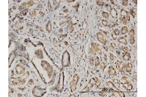 Immunostaining (ISt) image for anti-Eukaryotic Translation Initiation Factor 2, Subunit 2 Beta, 38kDa (EIF2S2) (AA 1-100) antibody (ABIN522380)