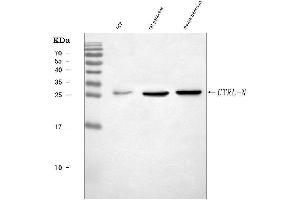 Western blot analysis of CTRL using anti-CTRL antibody (ABIN7601381).