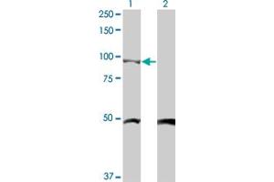Western Blot analysis of CTNNB1 expression in transfected 293T cell line by CTNNB1 monoclonal antibody (M03), clone 4F2. (CTNNB1 Antikörper  (AA 682-781))