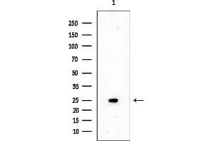 Western blot analysis of lysates from EC304 cells, using SOD2/MnSOD Mouse Monoclonal Antibody at 1/1000 dilution.