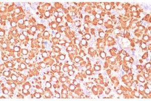 Immunohistochemistry of paraffin-embedded Rat ovary using MAP2K3 Polyclonal Antibody at dilution of 1:100 (40x lens). (MAP2K3 Antikörper)
