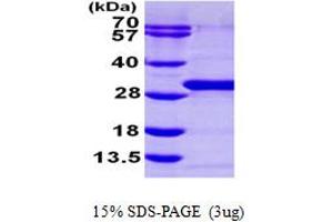 SDS-PAGE (SDS) image for RAB21, Member RAS Oncogene Family (RAB21) (AA 18-222) protein (His tag) (ABIN7529166) (RAB21 Protein (AA 18-222) (His tag))