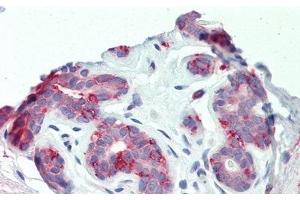 Immunohistochemistry (IHC) image for anti-Integrin beta-6 (ITGB6) (AA 131-371) antibody (ABIN7434668)