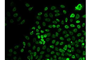Immunofluorescence analysis of HeLa cells using SMARCA4 antibody (ABIN6290438).