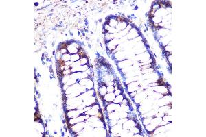 Immunofluorescence (IF) image for anti-Caspase 1 (CASP1) (AA 1-311) antibody (ABIN3021171)