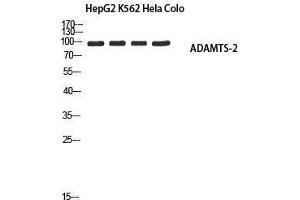 Western Blot (WB) analysis of HepG2 K562 HeLa Colo using ADAMTS-2 antibody. (Adamts2 Antikörper)