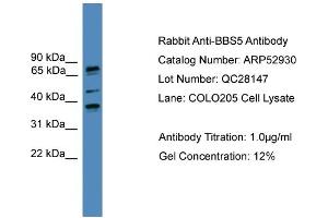 WB Suggested Anti-BBS5  Antibody Titration: 0.