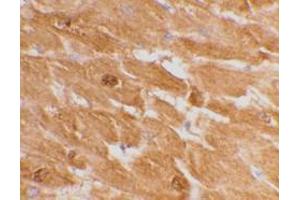 Immunohistochemical staining of human heart tissue using AP30192PU-N caspase-12 antibody (large) at 2 μg/ml. (Caspase 12 Antikörper  (large))