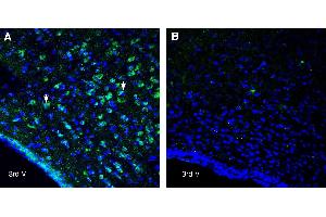 Expression of NPFFR1 in rat hypothalamusImmunohistochemical staining of perfusion-fixed frozen rat brain sections with Anti-Neuropeptide FF Receptor 1 (extracellular) Antibody (ABIN7581921), (1:400), followed by goat anti-rabbit-AlexaFluor-488. (NPFFR1 Antikörper  (Extracellular))