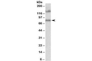 Western blot testing of human hippocampus lysate with EPB41L5 antibody at 1ug/ml. (EPB41L5 Antikörper)