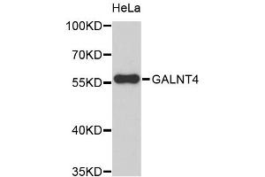 Western blot analysis of extracts of HeLa cells, using GALNT4 antibody (ABIN5972364). (GALNT4 Antikörper)