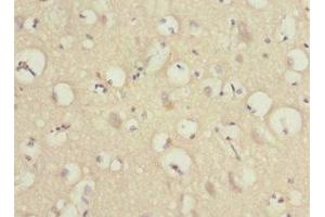 Immunohistochemistry of paraffin-embedded human brain tissue using ABIN7165996 at dilution of 1:100 (PRUNE2 Antikörper  (AA 1-250))