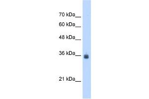 SDF4 antibody used at 2. (SDF4 Antikörper  (C-Term))