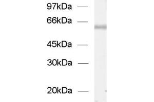 dilution: 1 : 1000, sample: enriched vesicles from rat spinal chord (ChT Antikörper  (AA 501-580))
