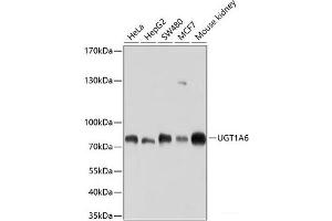 Western blot analysis of extracts of various cell lines using UGT1A6 Polyclonal Antibody at dilution of 1:1000. (UGT1A6 Antikörper)