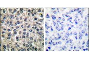 Immunohistochemistry (IHC) image for anti-Junction Plakoglobin (JUP) (AA 696-745) antibody (ABIN1533221)
