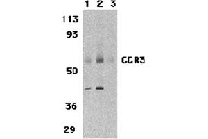 Western Blotting (WB) image for anti-Chemokine (C-C Motif) Receptor 3 (CCR3) (N-Term) antibody (ABIN1031307) (CCR3 Antikörper  (N-Term))