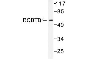 Image no. 1 for anti-Regulator of Chromosome Condensation (RCC1) and BTB (POZ) Domain Containing Protein 1 (RCBTB1) antibody (ABIN271804)