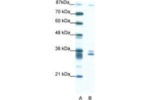Western Blotting (WB) image for anti-PBX/knotted 1 Homeobox 2 (PKNOX2) antibody (ABIN2460704) (PKNOX2 Antikörper)