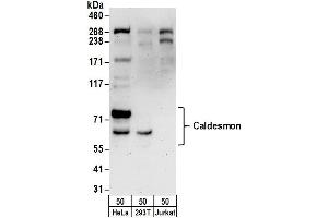 Western Blotting (WB) image for anti-Caldesmon 1 (CALD1) (AA 500-550) antibody (ABIN7455008)