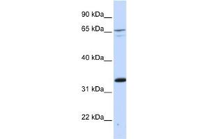 WB Suggested Anti-PSIP1 Antibody Titration:  0. (PSIP1 Antikörper  (Middle Region))