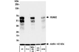 Western Blotting (WB) image for anti-Runt-Related Transcription Factor 2 (RUNX2) (AA 300-350) antibody (ABIN7795797)