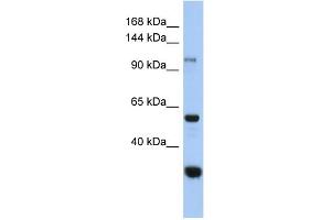 WB Suggested Anti-GANC Antibody Titration: 0. (GANC Antikörper  (Middle Region))