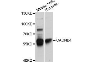Western blot analysis of extracts of various cells, using CACNB4 antibody. (CACNB4 Antikörper)