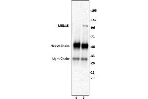 MED15 antibody (pAb) tested by Immunoprecipitation.
