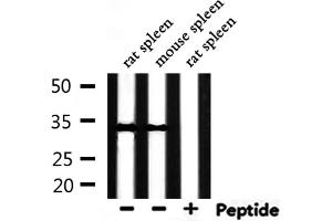 Western blot analysis of extracts from rat spleen, mouse spleen, using Phospho-Caspase 3 (Ser150) Antibody. (Caspase 3 Antikörper  (pSer150))