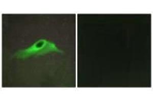Immunofluorescence analysis of HeLa cells, using Collagen IV α5 antibody.