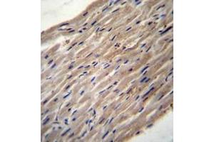 Immunohistochemistry analysis in formalin fixed and paraffin embedded human heart tissue reacted with PLOD1 / PLOD Antibody (N-term) followed which was peroxidase conjugated to the secondary antibody and followed by DAB staining. (PLOD1 Antikörper  (N-Term))