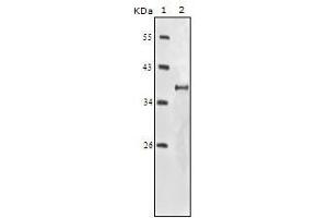 Western blot analysis using IGF1R-Beta mouse mAb against truncated IGF1R-Beta recombinant protein. (IGF1R-beta Antikörper)