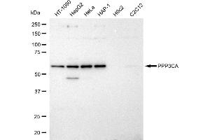 anti-Protein Phosphatase 3, Catalytic Subunit, alpha Isoform (PPP3CA) antibody