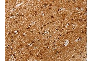 The image on the left is immunohistochemistry of paraffin-embedded Human brain tissue using ABIN7192664(SSX4 Antibody) at dilution 1/20, on the right is treated with synthetic peptide. (SSX4 Antikörper)