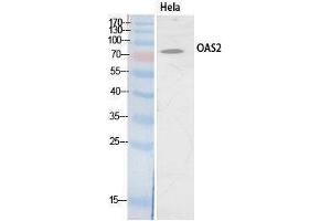 Western Blotting (WB) image for anti-2'-5'-Oligoadenylate Synthetase 2, 69/71kDa (OAS2) (Internal Region) antibody (ABIN3181072) (OAS2 Antikörper  (Internal Region))