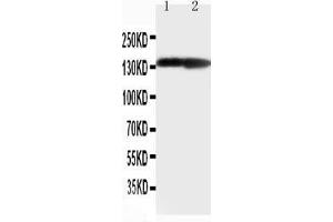 Anti-Collagen II antibody, Western blotting Lane 1: Rat Heart Tissue Lysate Lane 1: Rat Brain Tissue Lysate (COL2A1 Antikörper  (C-Term))