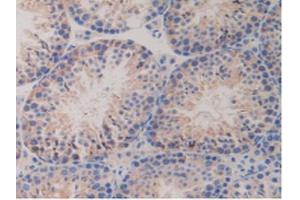 IHC-P analysis of Mouse Testis Tissue, with DAB staining. (PDGFRB Antikörper  (AA 337-583))