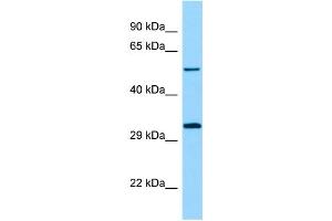 WB Suggested Anti-STK33 Antibody Titration: 1. (STK33 Antikörper  (N-Term))