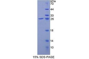 SDS-PAGE analysis of Mouse GPX6 Protein. (Glutathione Peroxidase 6 Protein (GPX6))