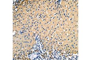 Immunohistochemistry of paraffin embedded human tonsil using IFIT5 (ABIN7074334) at dilution of 1:500 (300x lens) (IFIT5 Antikörper)