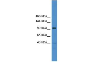 WB Suggested Anti-TRAK1  Antibody Titration: 0. (TRAK1 Antikörper  (Middle Region))