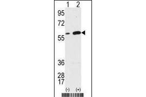 Western blot analysis of Vimentin (arrow) using Vimentin Antibody (Center) (ABIN389213 and ABIN2839368). (Vimentin Antikörper  (AA 152-181))