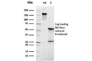 SDS-PAGE Analysis Purified C1QB Mouse Monoclonal Antibody (C1QB/2961). (C1QB Antikörper  (AA 41-188))