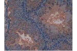 IHC-P analysis of Mouse Testis Tissue, with DAB staining. (FLT4 Antikörper  (AA 30-326))