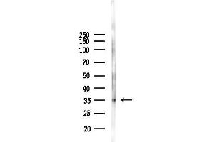 anti-Homeobox B2 (HOXB2) (N-Term) antibody