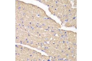 Immunohistochemistry (IHC) image for anti-Voltage-Dependent Anion Channel 1 (VDAC1) (AA 1-283) antibody (ABIN6213993) (VDAC1 Antikörper  (AA 1-283))